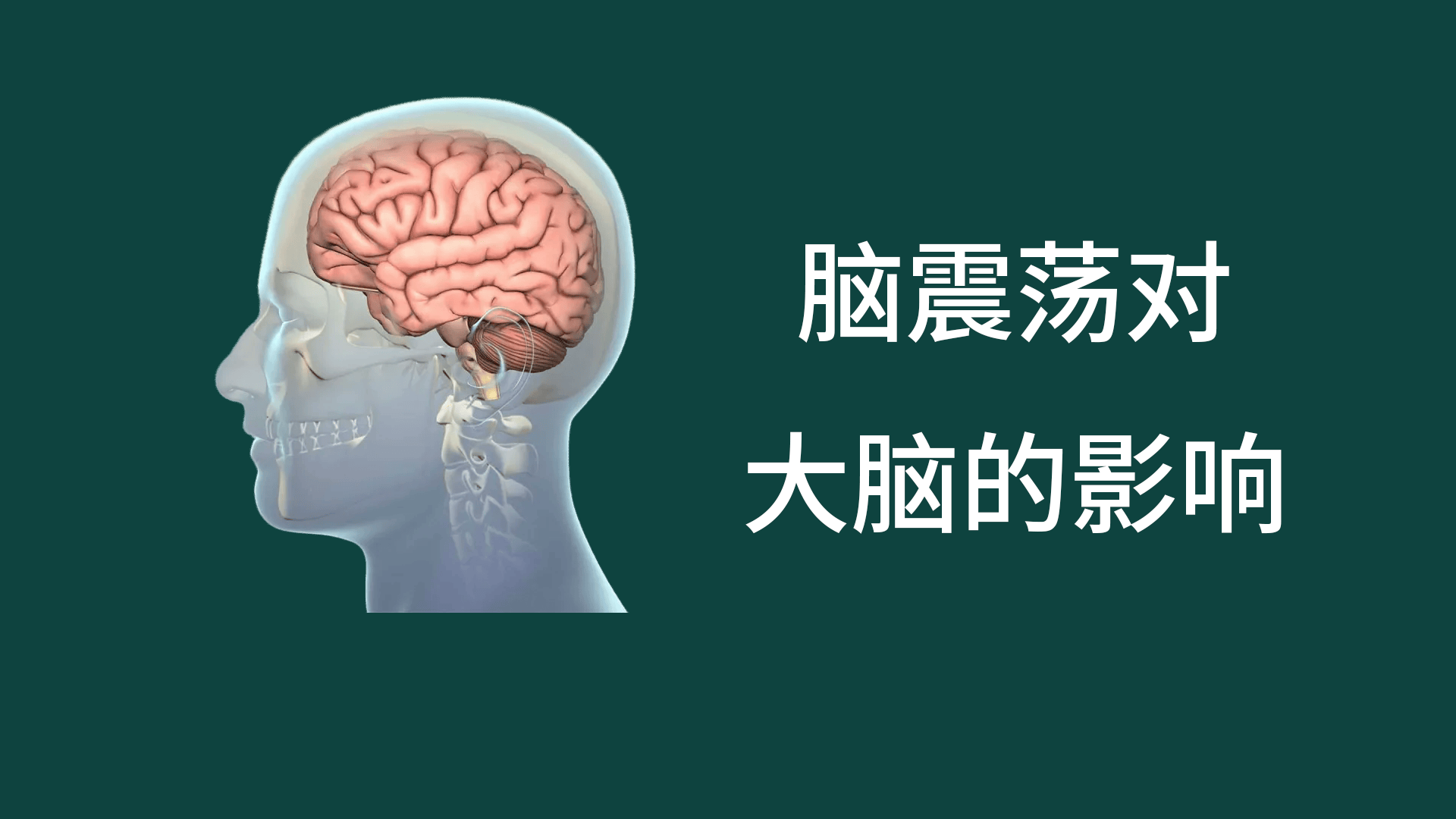 腦震蕩