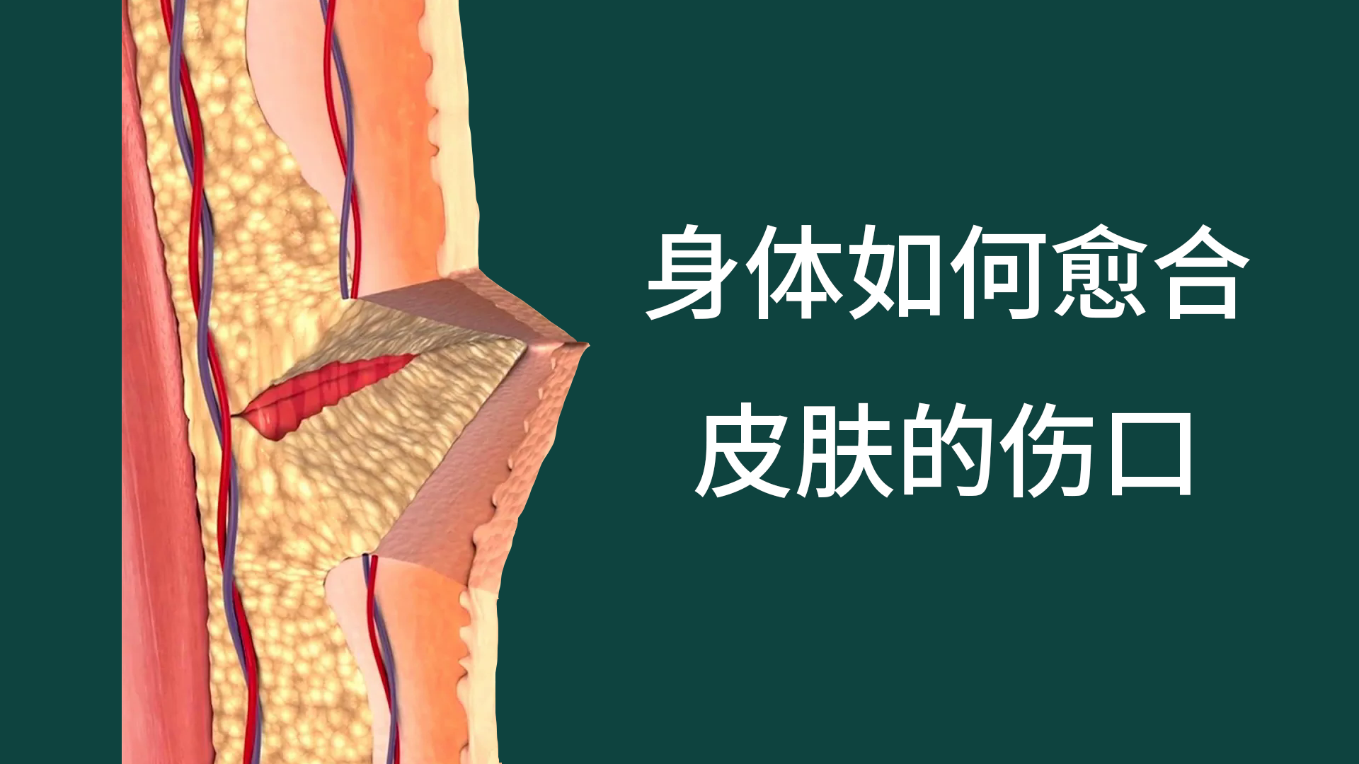 身體如何愈合皮膚上的傷口