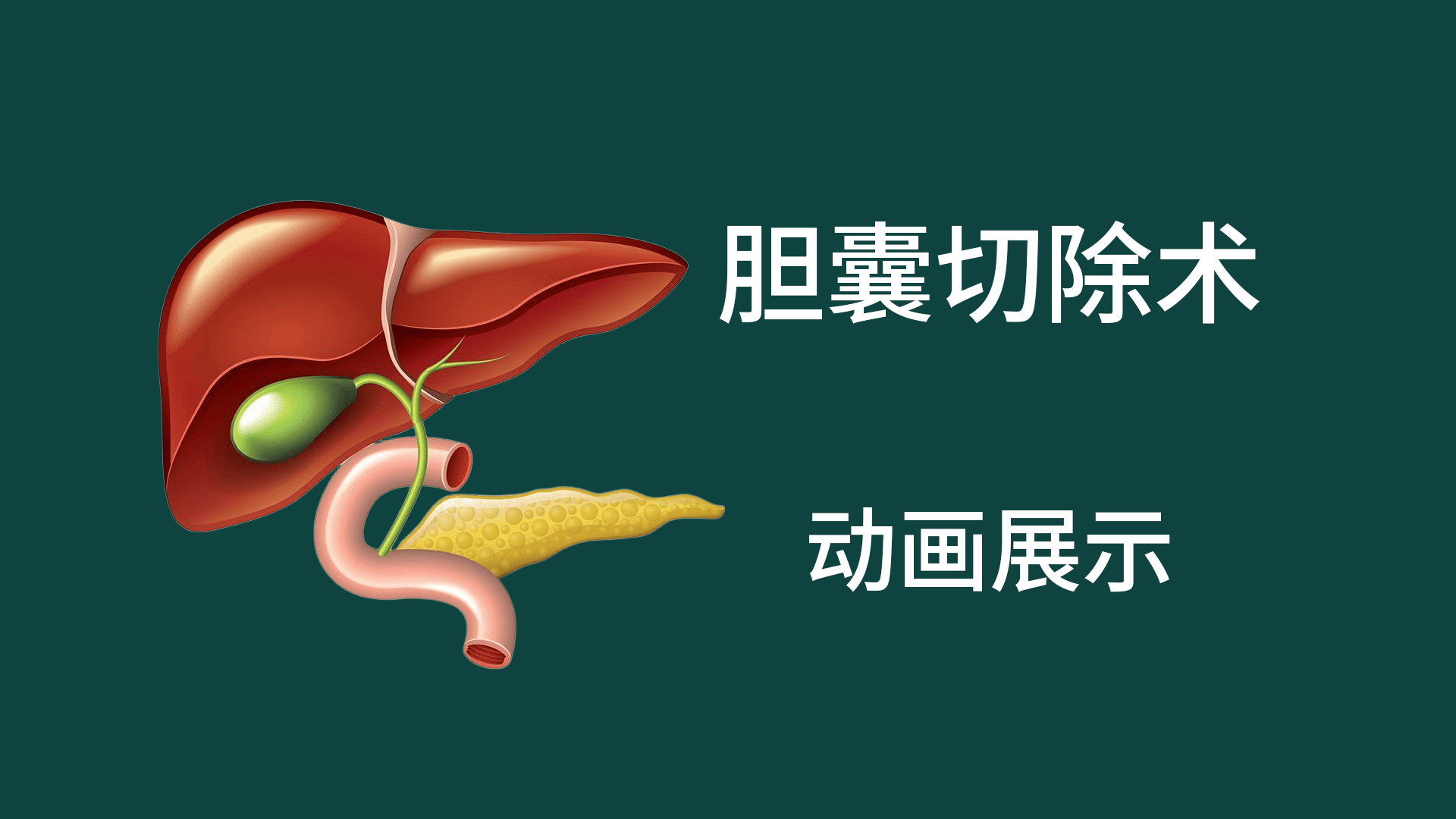 膽囊切除術
